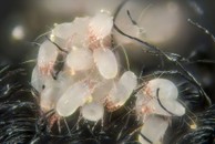 Dust Mites